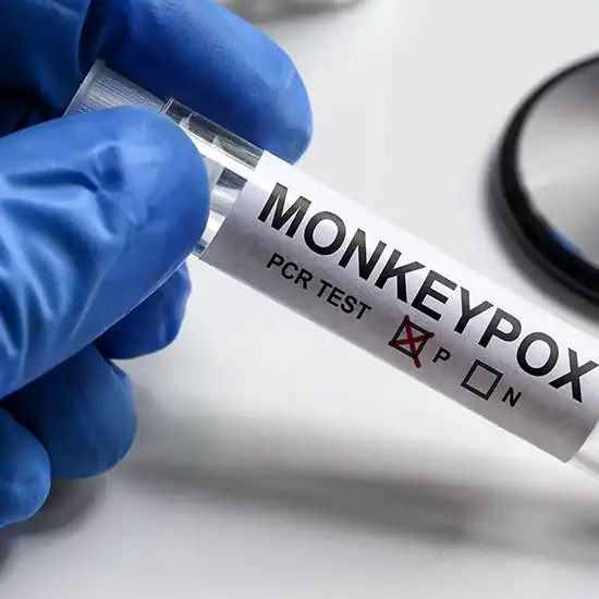 Monkeypox Virus PCR